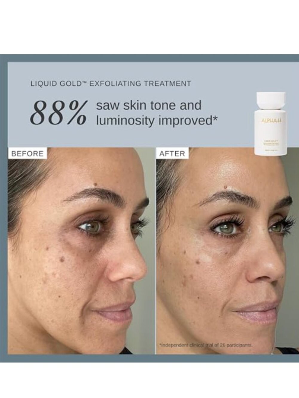 Alpha-H Liquid Gold Exfoliating Treatment with 5% Glycolic Acid - Picture 7 of 7